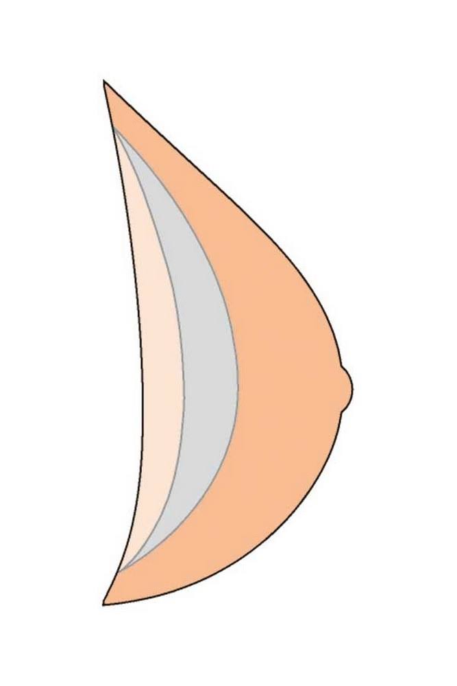 Breast Form with Comfort F182